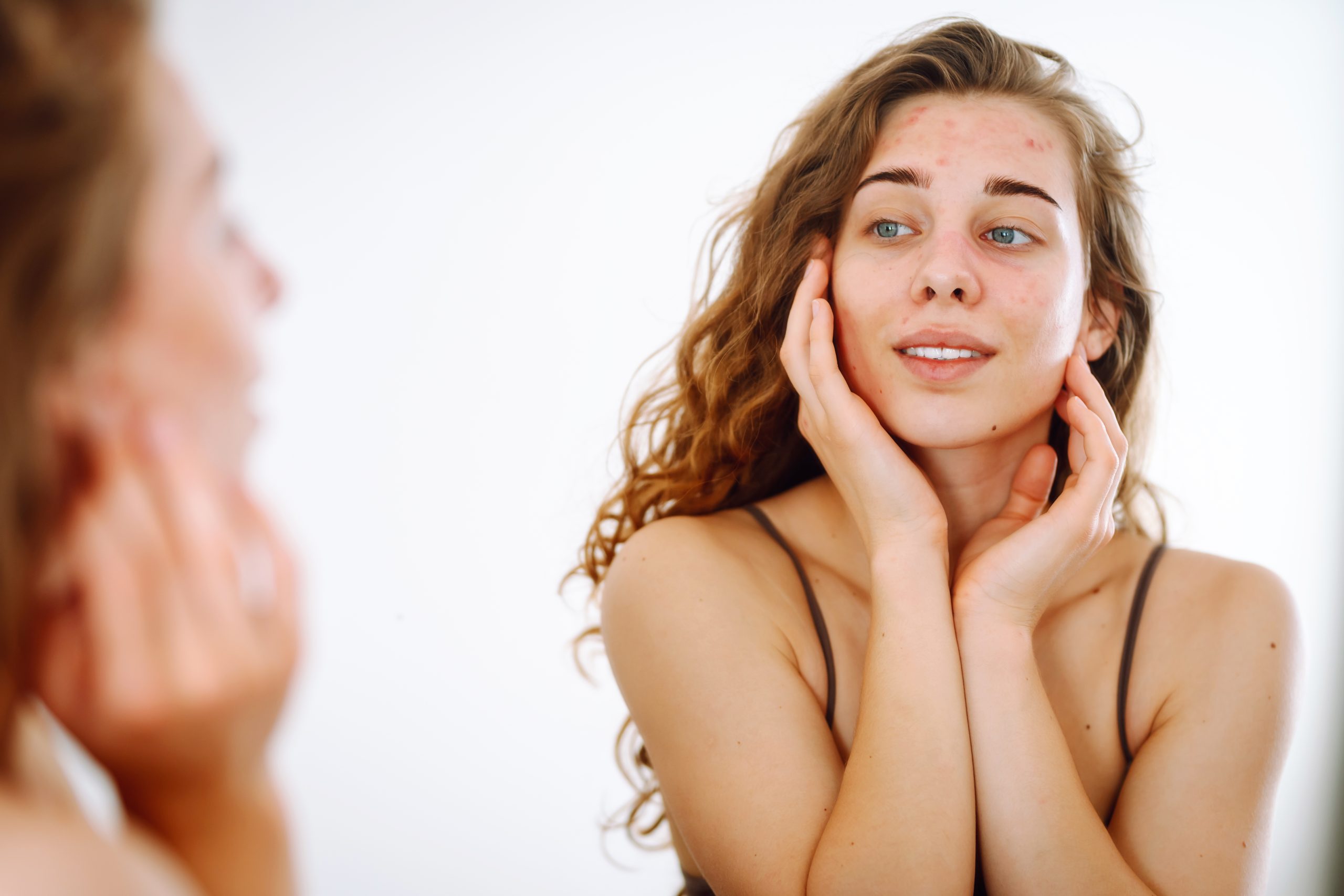 Lightweight oil-free primer for acne-prone skin to control shine and prevent breakouts.