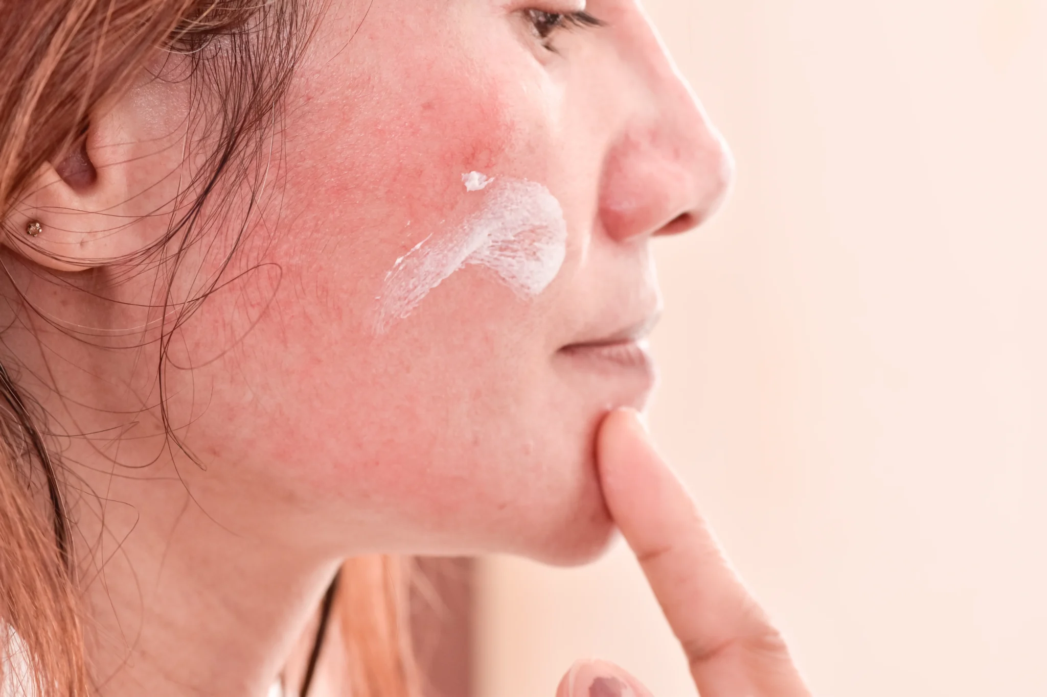Dermatologist-approved best skin care line for redness and sensitive skin.