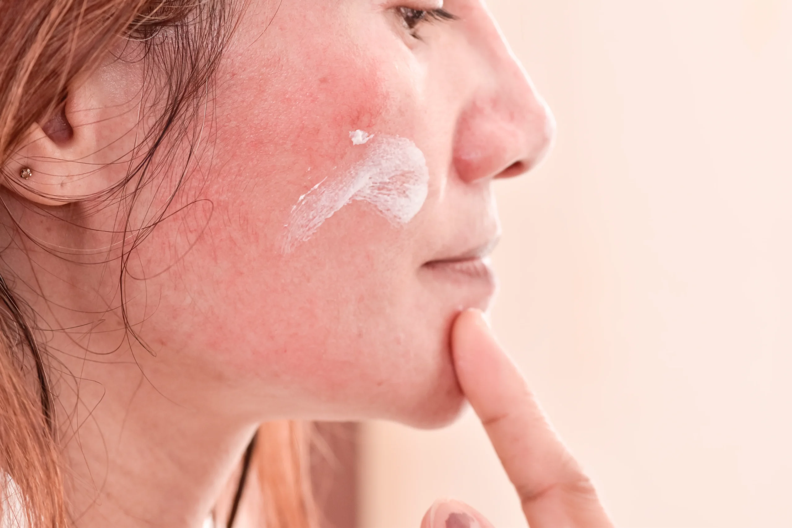 Dermatologist-approved best skin care line for redness and sensitive skin.