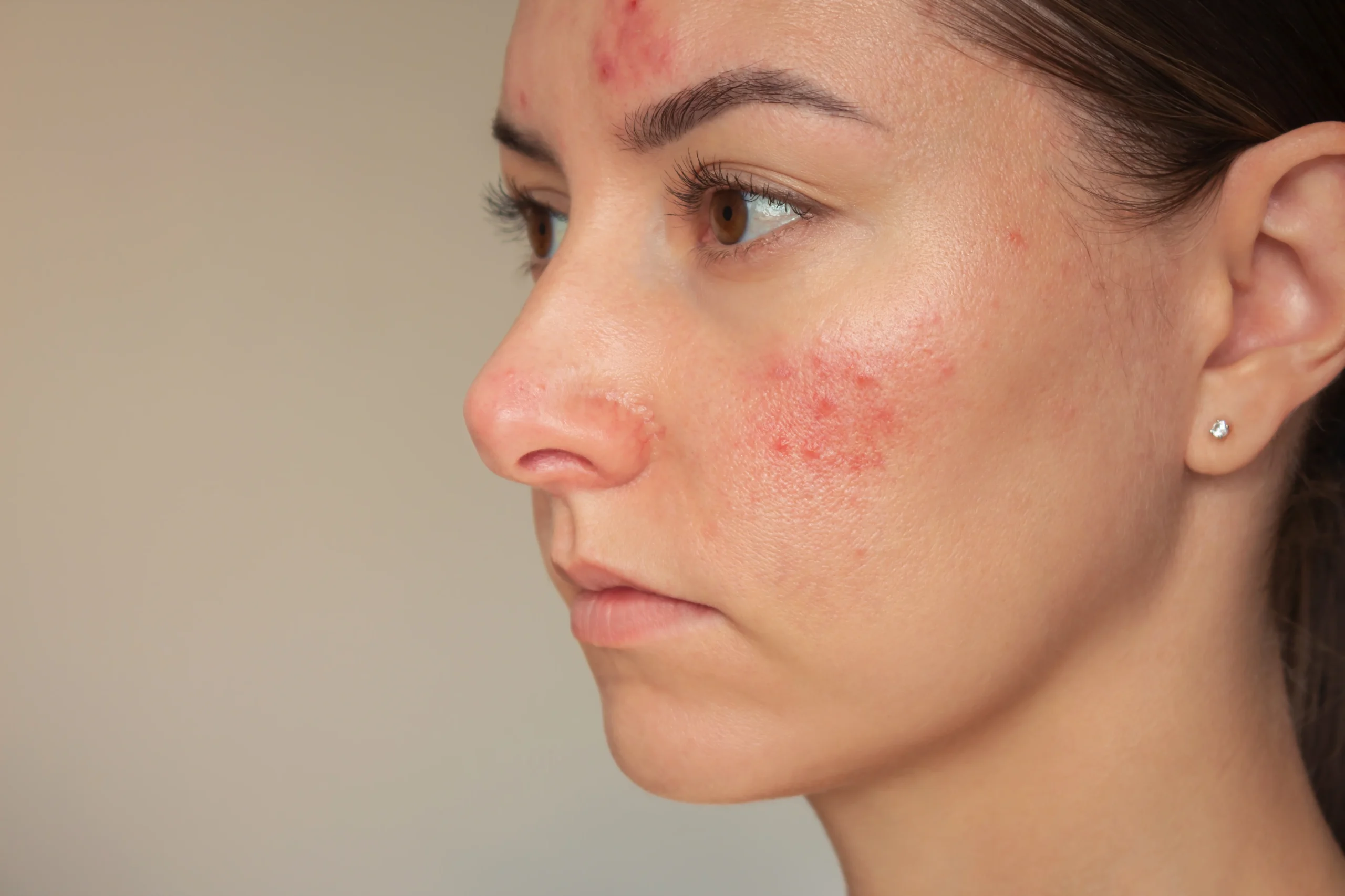 Gentle face cleanser for redness and sensitive skin care.