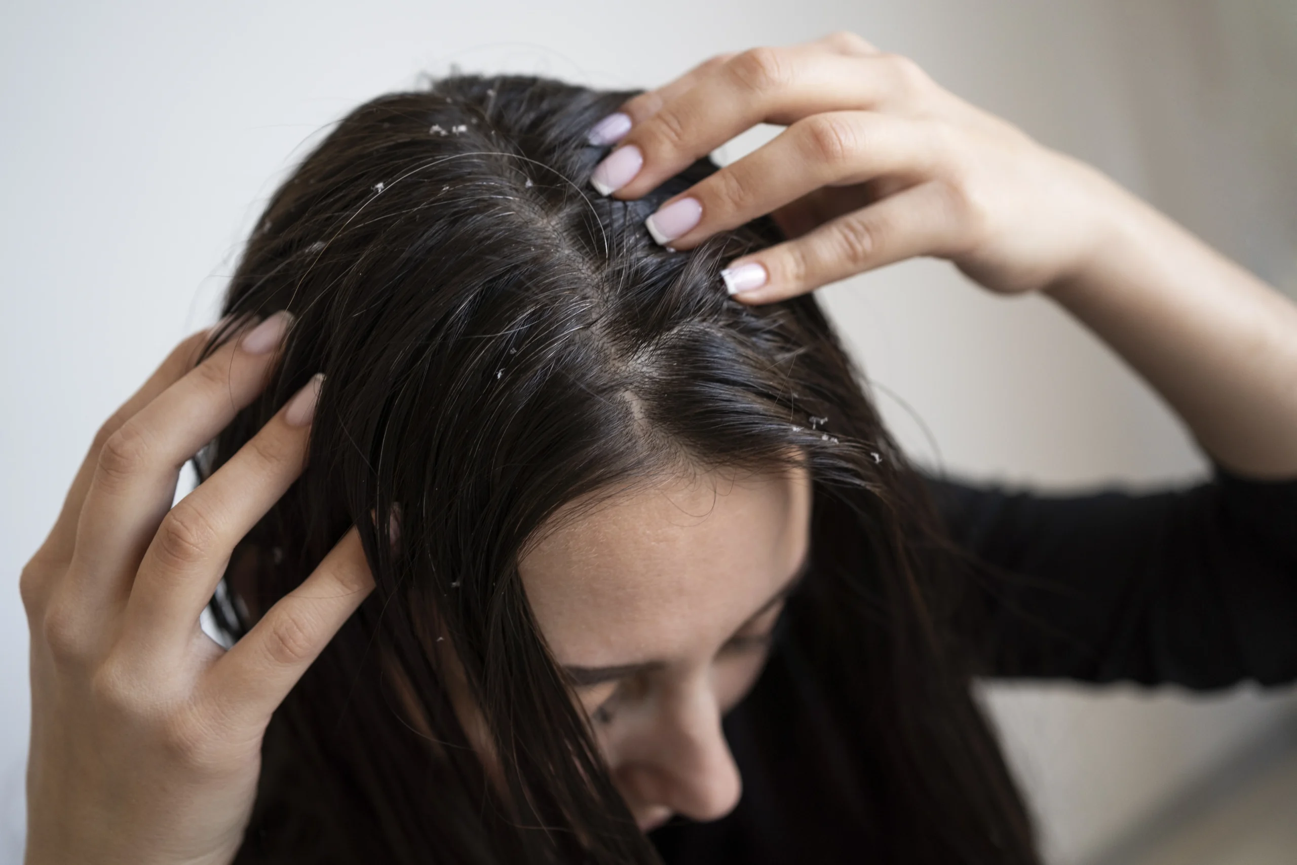Daily hair care routine for dry scalp hydration and healthy hair