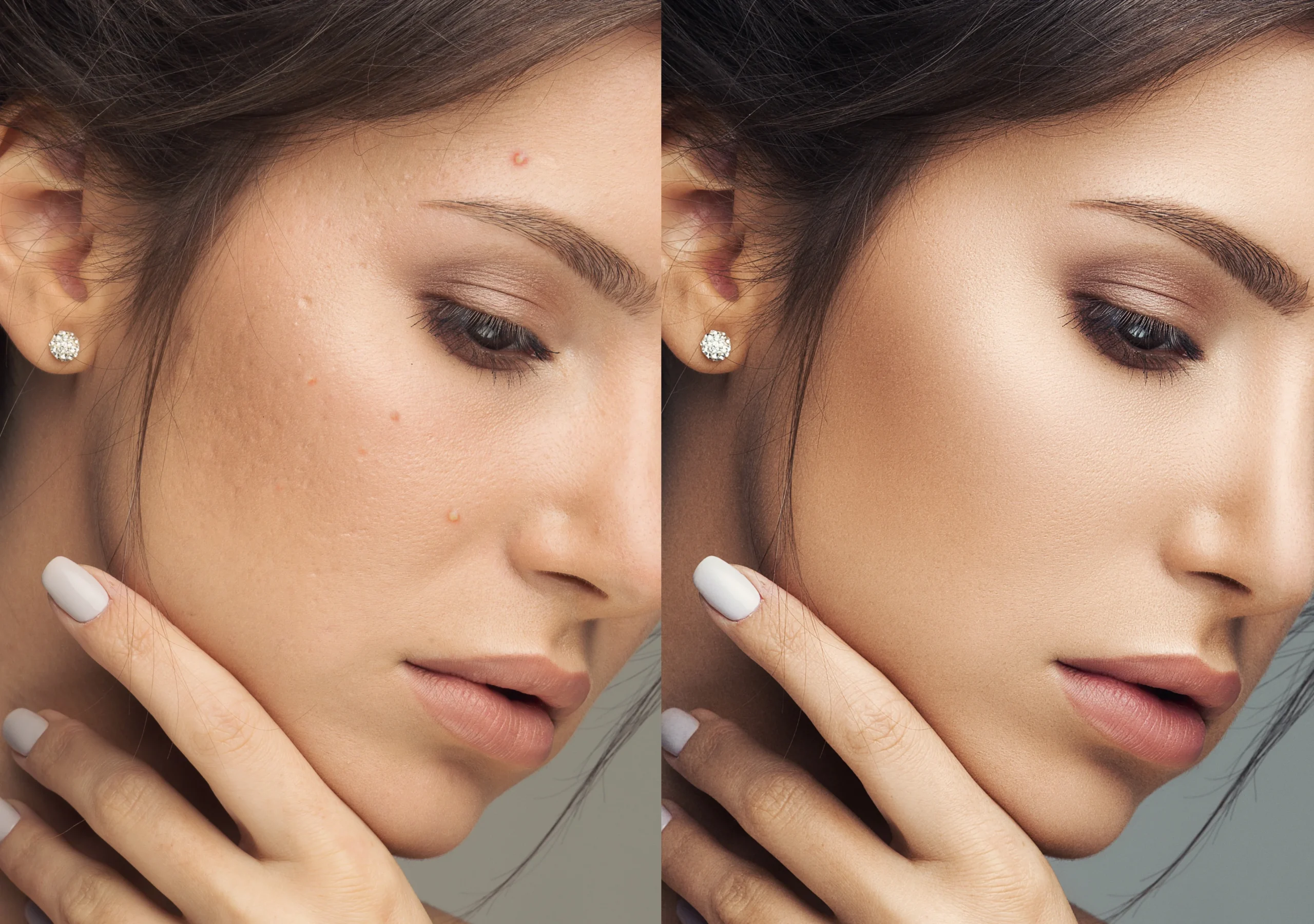 Before and after contouring results creating sculpted and balanced facial features