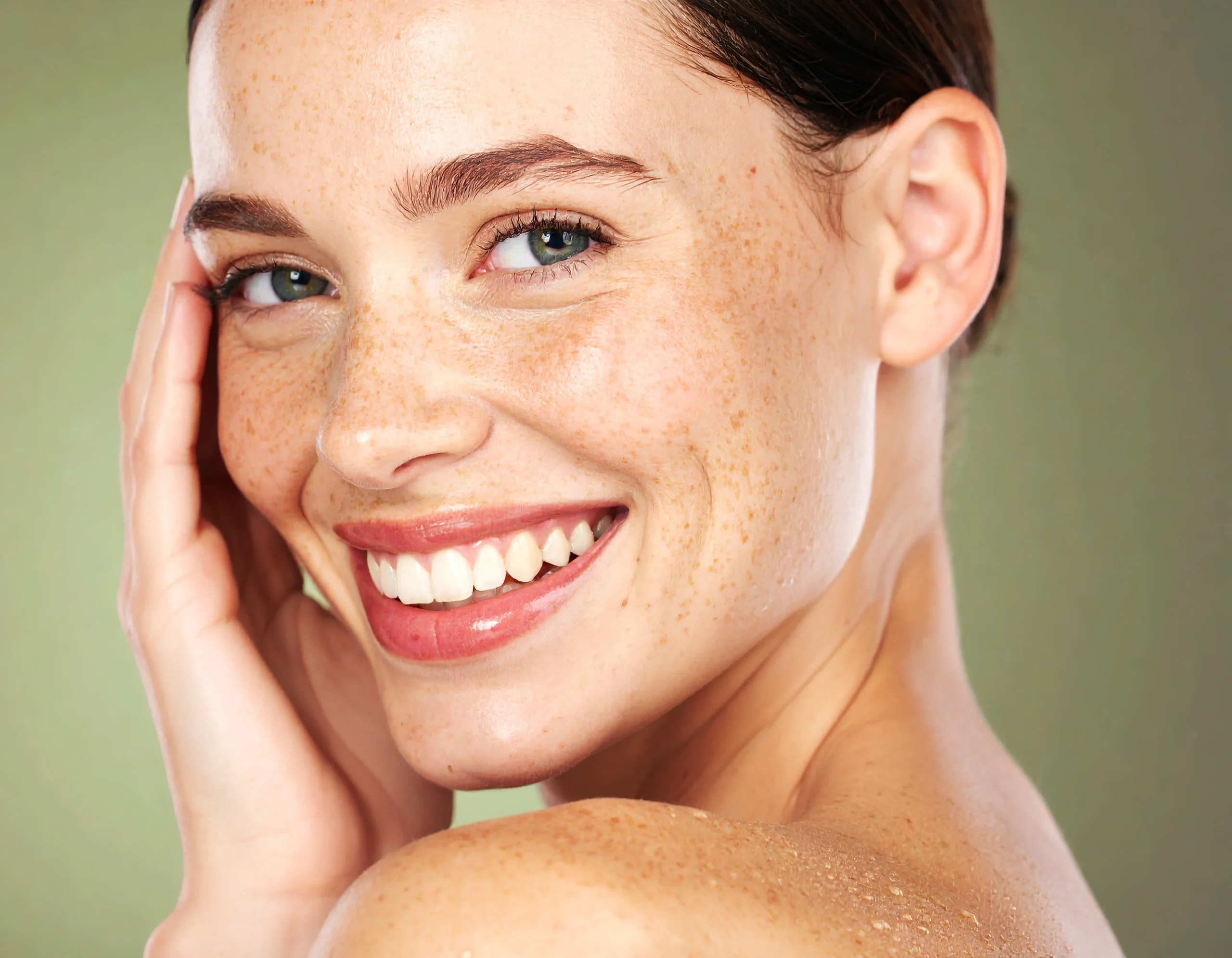 Dark spots fading and tone improving with adapalene.